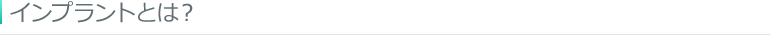 インプラントとは
