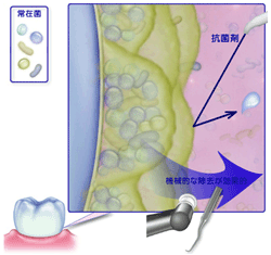 バイオフィルム