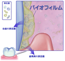 バイオフィルム