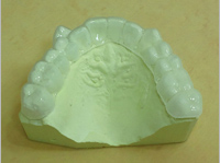 歯ぎしり防止用のマウスピース