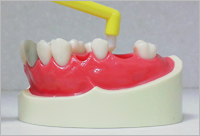 入れ歯の洗浄、掃除