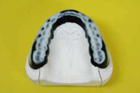 スポーツマウスガード